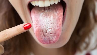 Nấm Candida sinh dục: Nguyên nhân, triệu chứng và phòng ngừa